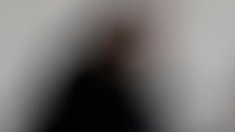 Gianluigi Donnarumma luego de recibir el golpe al rostro.