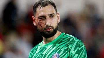 Gianluigi Donnarumma luego de recibir el golpe al rostro.