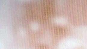 El yerno de Dulce desmintió que la cantante tenga cáncer o un pulmón colapsado.