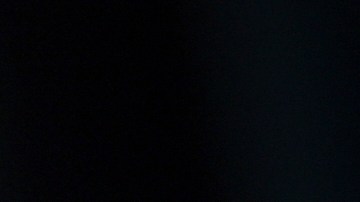 Gal Gadot agregó que tuvo que ser operada de emergencia.