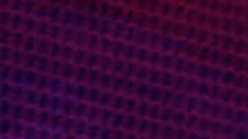 Miguel Ríos tropezó y cayó sobre el escenario.