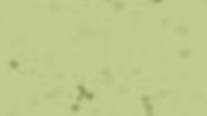 Collage,Illustration,Of,Two,Human,People,Hands,Fingers,Hold,Touch