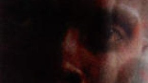 Tuberculosis enfermedad