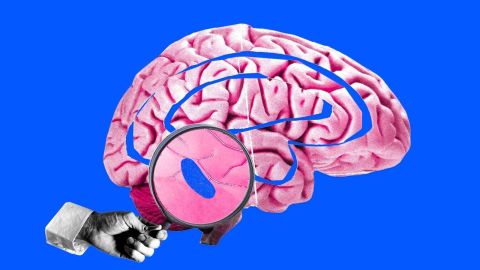 Cerebro