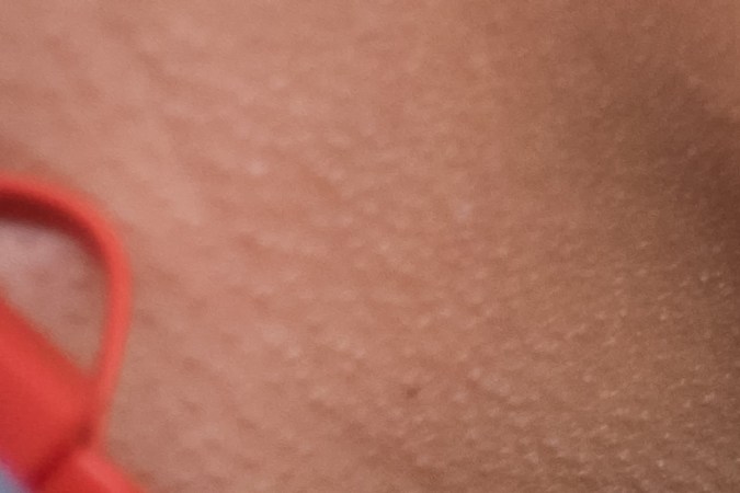 El consumo periódico de ciertos alimentos, como las gaseosas, puede generar daños en los riñones.