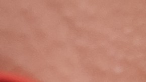 El consumo periódico de ciertos alimentos, como las gaseosas, puede generar daños en los riñones.