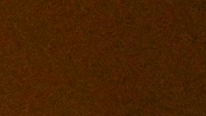 Uno de los sectores más afectados por la abrupta congelación de los fondos en África es la salud, al ser uno de los principales destinos de la ayuda estadounidense al continente.