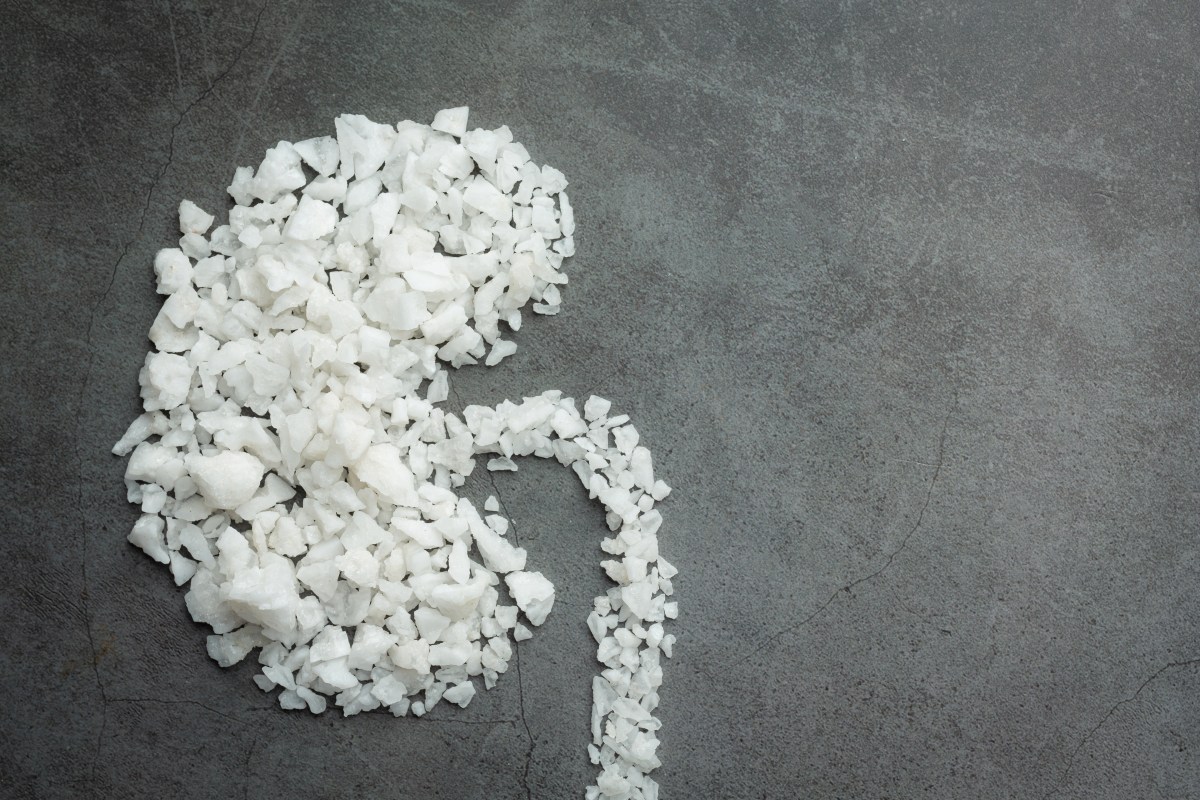 El alimento que debes limitar para proteger tus riñones