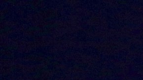 Este nuevo episodio de se suma a las dificultades médicas que ha enfrentado Pantoja en los últimos años.