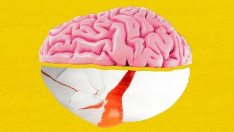 Cerebro