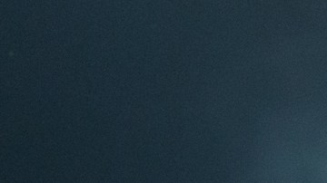 Elton John sufre la pérdida de gran parte de su visión a causa de una infección ocular.