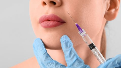 El cirujano señala que hoy en día hay más variedad y que además se usan en combinación con otros tratamientos para lograr una mejoría global en el rostro.