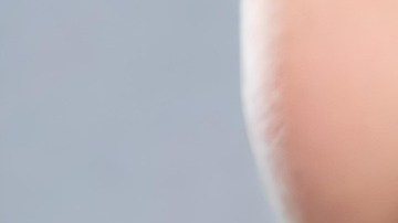 La dentadura es fundamental para tener una estética dental impecable