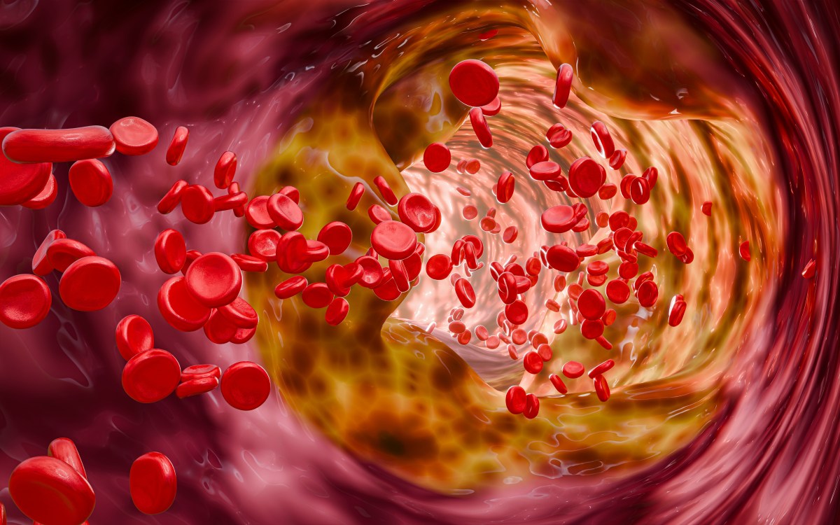 Desintoxica tus arterias: Descubre 5 alimentos para un sistema circulatorio saludable