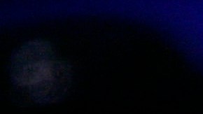 Dicen que Billy Joel ha sufrido problemas de audición, visión y equilibrio.