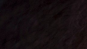 Billy Joel canceló hace pocos sus conciertos tras ser diagnosticado con una enfermedad cerebral.