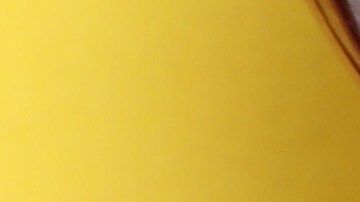 Hay algunos alimentos que debemos evitar para preservar la salud de los riñones.