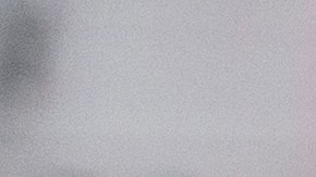 Exhausted,Schooler,Girl,Suffering,From,Doing,Homework,,Tired,From,Studying