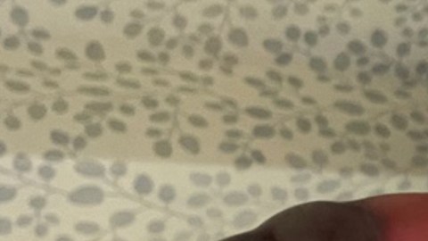 Mano mordida por serpiente venenosa.