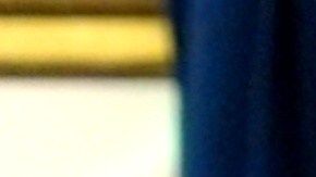 Elon Musk dijo que el golpe en el ojo se lo hizo jugando con su hijo.