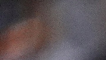 Técnico de Chucky Lozano brinda actualización sobre su lesión.