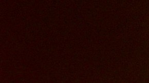 Billy Joel fue diagnosticado recientemente con hidrocefalia normotensiva.