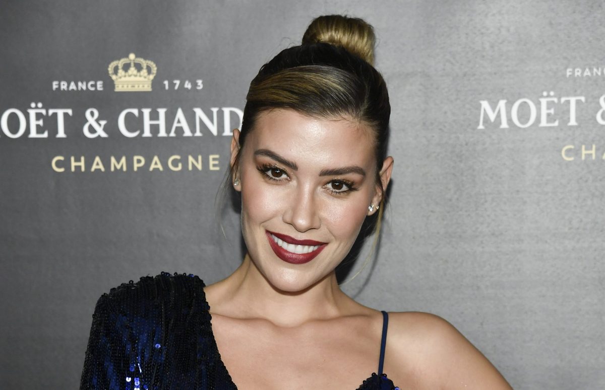 Michelle Salas confiesa que sufre de una enfermedad en la piel
