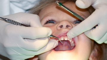 Caries