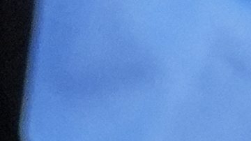 Mundial de Clubes: Jamal Musiala sufre escalofriante lesión en su tobillo izquierdo