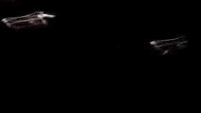 Coldplay dejó al descubierto a una pareja que estaba siendo infiel.