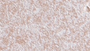 Se recomienda a los consumidores verificar la información del tocino Oscar Mayer.