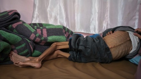 Entre el 2 de marzo y el 19 de mayo el bloqueo fue total, mientras que el flujo de ayuda es ahora muy limitado e insuficiente.