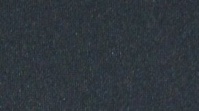 Ana Brenda compartió una serie de fotografías en las que reveló que la zona más afectada es su cuello.