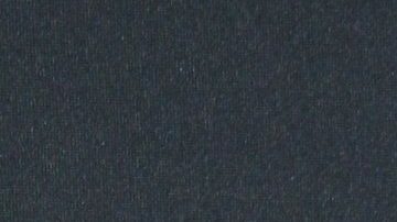 Ana Brenda compartió una serie de fotografías en las que reveló que la zona más afectada es su cuello.