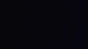 Jessie J se sometió a su primera cirugía de cáncer de mama en junio.