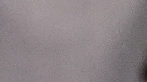 Tyreek Hill, el receptor más veloz de la NFL, sufre escalofriante lesión en la rodilla