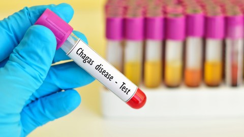 Enfermedad de Chagas