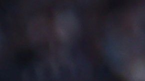 Dagoberto Espinoza sufre dura lesión que lo mandará al quirófano.