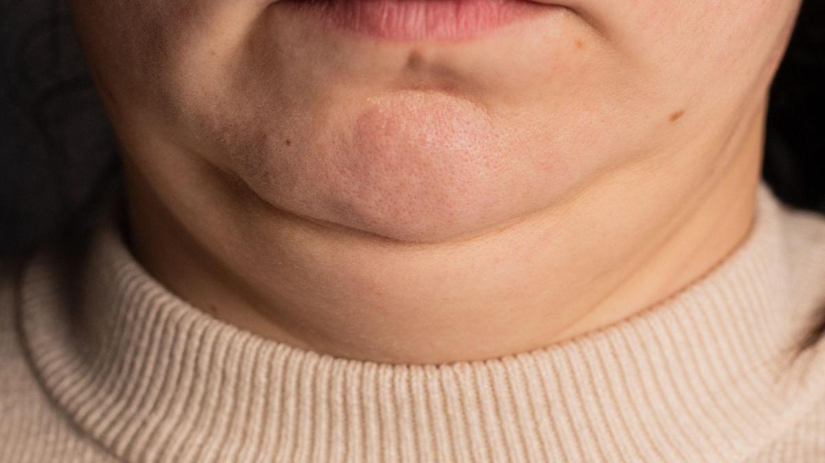 La circunferencia de tu cuello puede revelar problemas de salud
