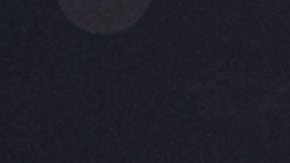 Belinda, cantante, enfrenta una situación de salud con su rodilla.