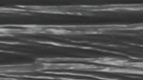 La remolacha contiene biocompuestos que ayudan a oxigenar las células de los músculos y mejoran el rendimiento.