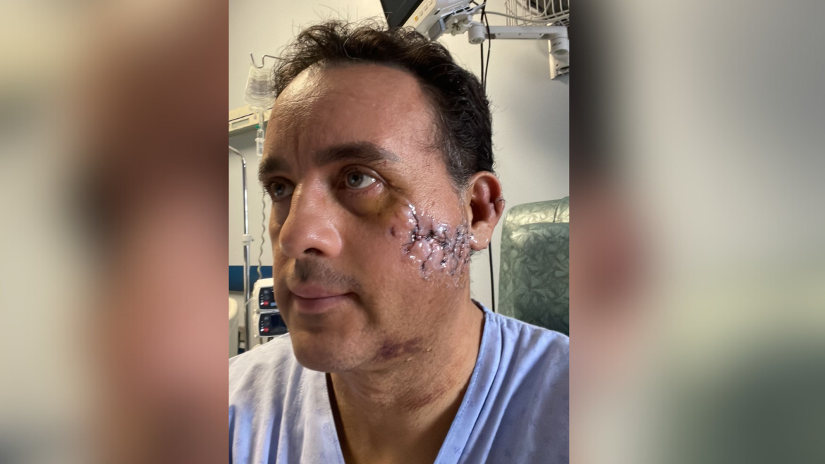 Un biólogo marino mexicano cuenta cómo sobrevivió a un feroz ataque de tiburón