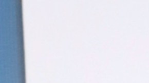 Manelyk González, creadora de contenido, habla de las operaciones y tratamientos estéticos que se ha hecho.