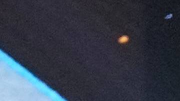 Miss Jamaica se recupera de la caída que sufrió en el Miss Universo.