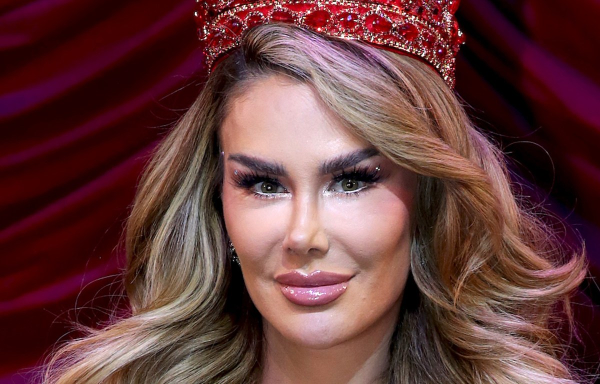 ¿En qué consiste la queratopigmentación ocular, el tratamiento que está de moda entre los famosos? 