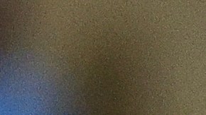 Carlos Rodón se sometió a una cirugía en el codo izquierdo.