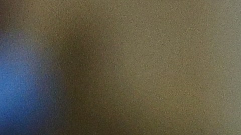 Carlos Rodón se sometió a una cirugía en el codo izquierdo.