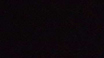 Billy Joel fue diagnosticado este año con hidrocefalia normotensiva.