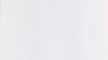 Ninel también reveló que pretendo someterse a dos nuevas cirugías.