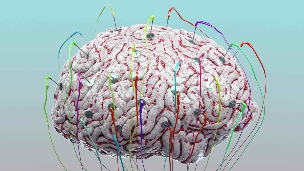 ¿Puede la estimulación cerebral mejorar nuestra memoria? Descubre la respuesta